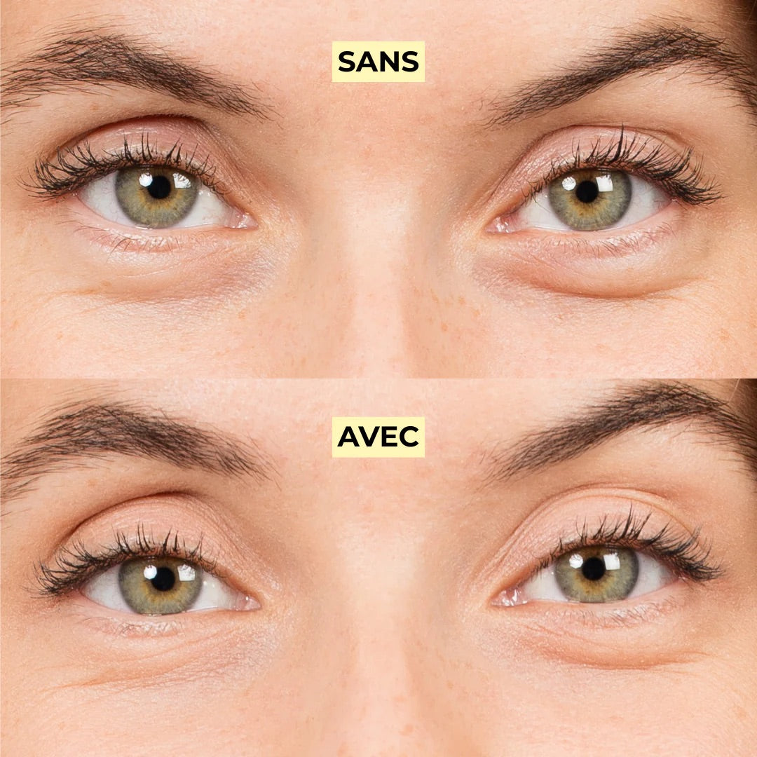 Anti-cernes Soin - Teinté